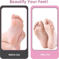 4.8IN Longer Electric Foot Callus Remover with 80pcs Sandpaper Discs Tools for Dead Skin (Pink) - Image 4